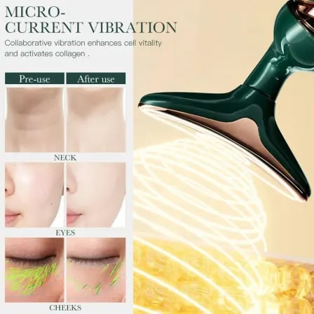 3 In 1 Face Massager। চেহারা থেকে বয়সের ছাপ গায়েব – ৩