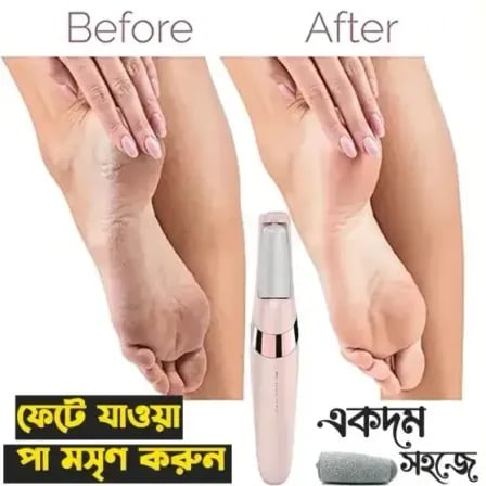 Pedicure Tool | Dead Skin Remover