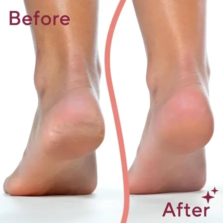 Flawless Pedicure Tool। রুক্ষ পা হোক নরম ও সুন্দর! – ৩